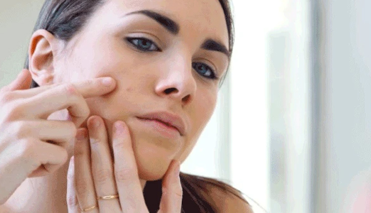 5 Home Remedies To Get Rid Of Acne Scars - Lifeberrys.com