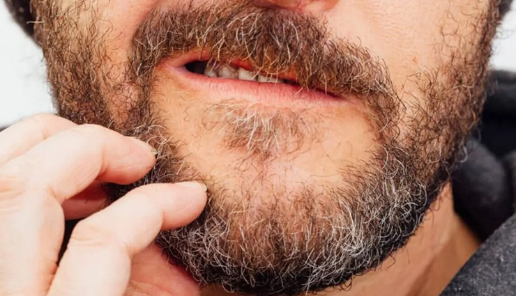 8 Effective Remedies To Treat Beard Dandruff 