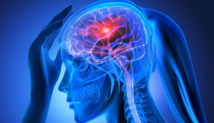 everything about brain stroke,brain stroke information,what is a brain stroke,causes of brain stroke,brain stroke symptoms,brain stroke prevention,brain stroke treatment,types of brain stroke,brain stroke recovery,how to recognize a brain stroke,brain stroke risk factors,brain stroke diagnosis,brain stroke first aid,long-term effects of brain stroke,brain stroke rehabilitation,brain stroke management,understanding brain stroke,brain stroke emergency response,brain stroke myths and facts,brain stroke lifestyle changes