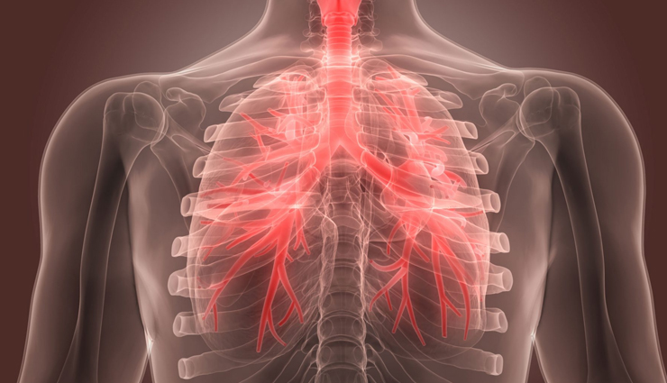 6 Most Common Causes Of Chest Congestion Lifeberrys Com   Causes 4 1648820815 Lb 