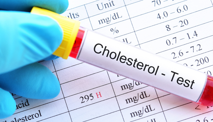 सिर्फ 24 घंटे में इन 5 आदतों से बढ़ सकता है कोलेस्ट्रॉल, तुरंत करें बचाव!