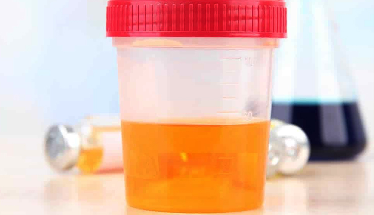 urine colour,urine color health,Health tips,healthy living