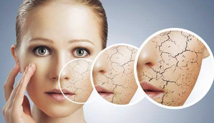 Easy Home Remedies To Get Rid Of Dry Flaky Skin On Face