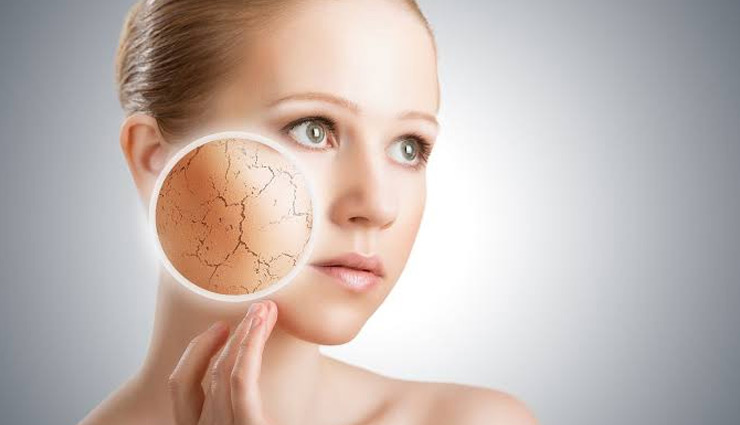 5 Ways To Treat Very Dry Skin Naturally