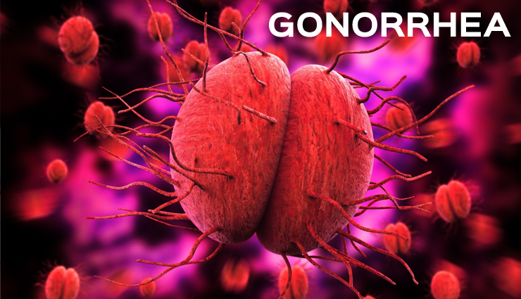 9 Best Remedies for Gonorrhea - lifeberrys.com