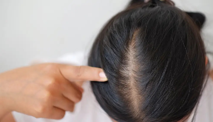 hot oil hair mistake,hair care tips,hair damage prevention,hot oil hair risks,hair health warning,common hair care mistakes,hair damage causes,safe hair care practices,hot oil treatment risks,hair damage signs