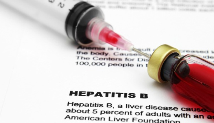 6 Natural Remedies For Hepatitis B - Lifeberrys.com