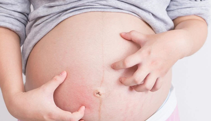 skin-rash-during-pregnancy-skin-changes-and-problems-during-pregnancy