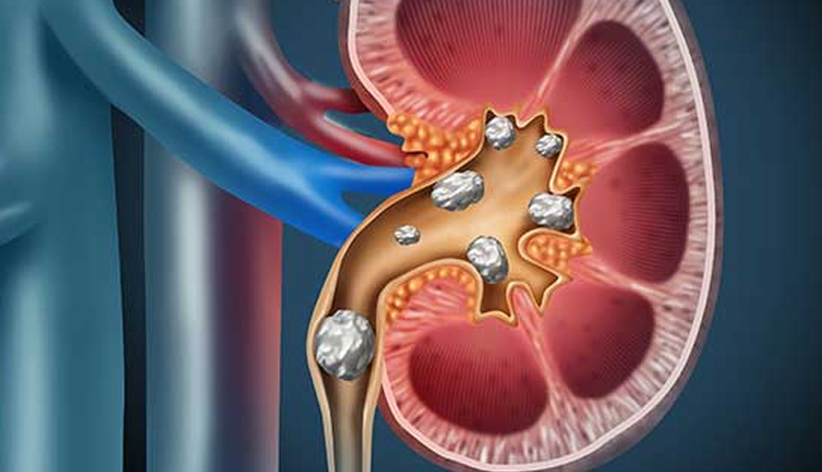 harmful effects of consuming vitamin c,healthy living,Health tips