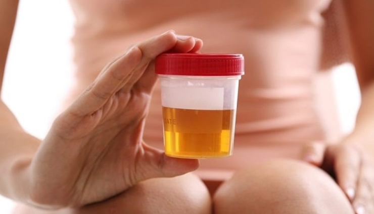 urine colour,urine color health,Health tips,healthy living