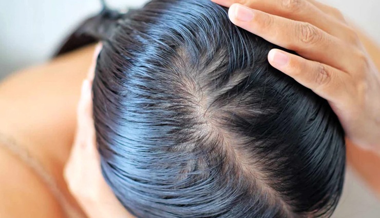 How To Treat Scabs On The Scalp 8139