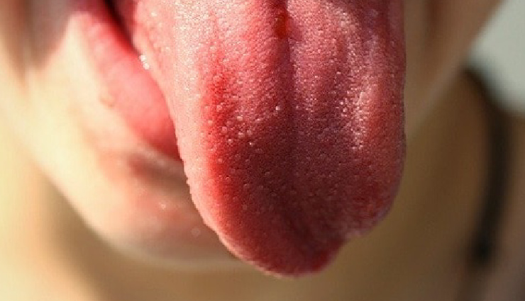 tongue color health,tongue color meanings,tongue health,white tongue causes,yellow tongue causes,red tongue meaning,blue tongue meaning,health signs from tongue color,tongue color and health,tongue color changes