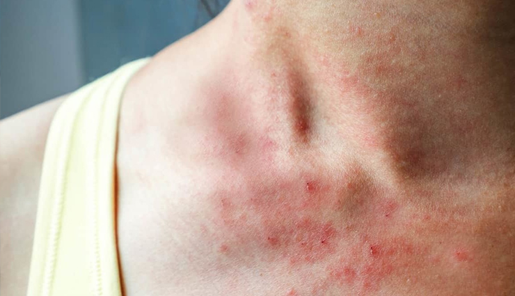 Red Dots On Skin Vitamin Deficiency