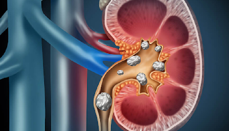 international men’s day 2024,common urological conditions in men,men’s health issues,urological problems in men,men’s urinary tract health,prostate health awareness,kidney health in men,common male health problems,men’s urological health tips,male health awareness 2024