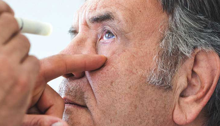 cataracts symptoms,cataracts causes,causes of cataracts,cataracts signs,cataracts risk factors,cataracts prevention