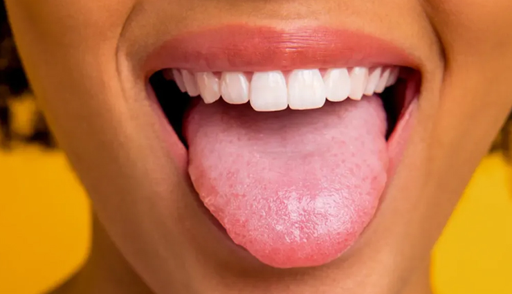 Here Is What The Color Of Your Tongue Say About Your Health ...