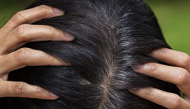 10-home-remedies-to-help-you-get-rid-of-white-hair-lifeberrys