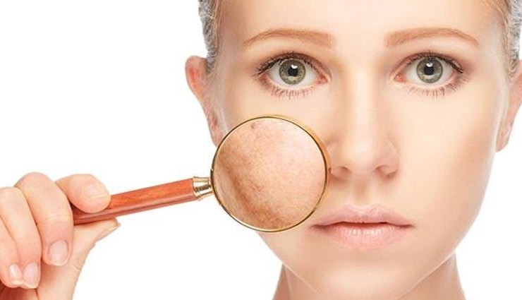 Want To Get Rid Of White Spots On Face Try These Effective Remedies